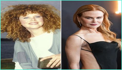 Nicole Kidman's 